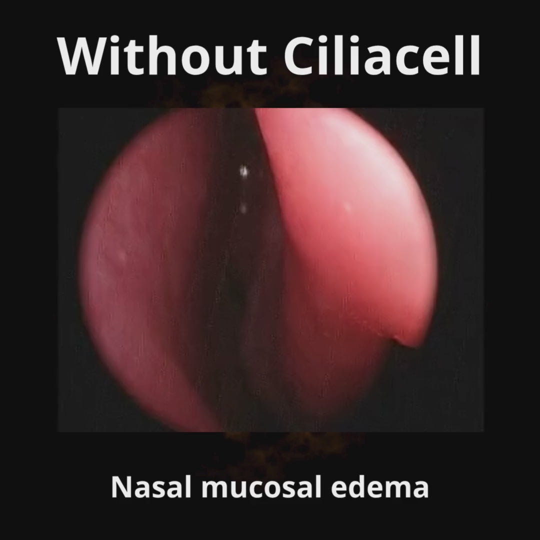 Load video: CiliaCell Nasal Spray - Children