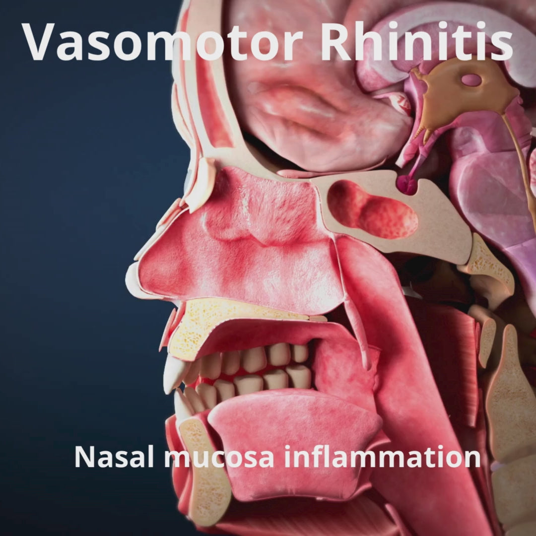 Carica video: Celmast Spray Nasale - Bambini